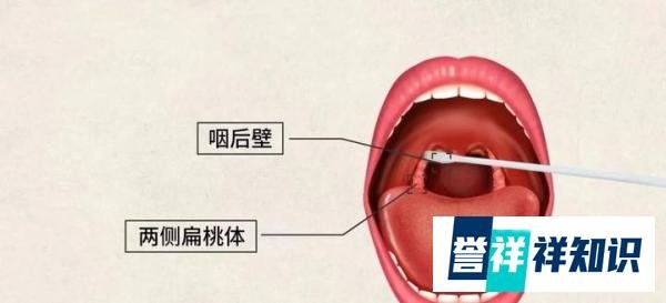 卫健委：咽拭子采集至少擦拭6次，欢迎群众监督举报