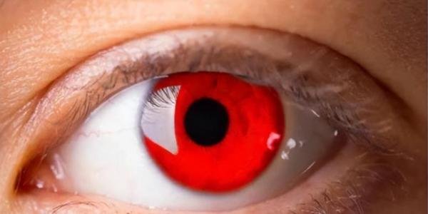 世界上最稀有的五种瞳孔颜色，你见过哪种？