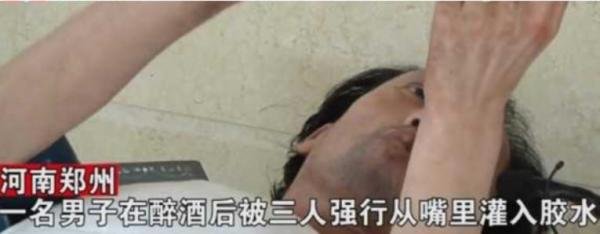 河南一工人喝醉遭老板、同事强灌PVC胶水昏迷3月医药费高达100万