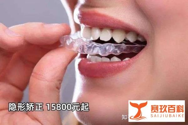 东莞口腔牙齿矫正多少钱价格表2024，怎么选择可靠的正畸医生?