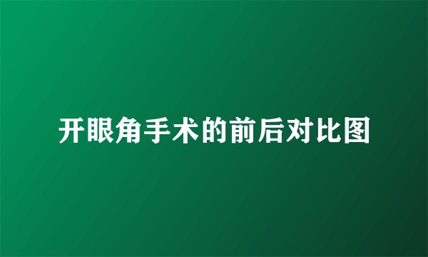 开眼角手术的前后对比图