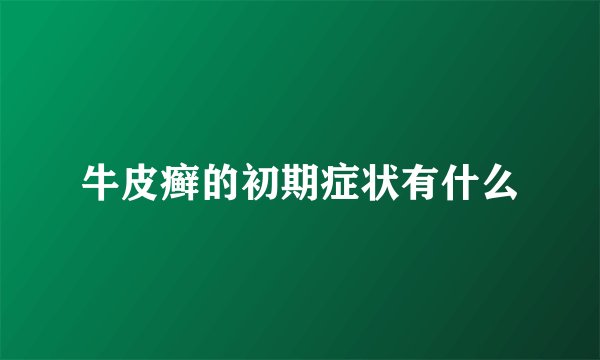 牛皮癣的初期症状有什么