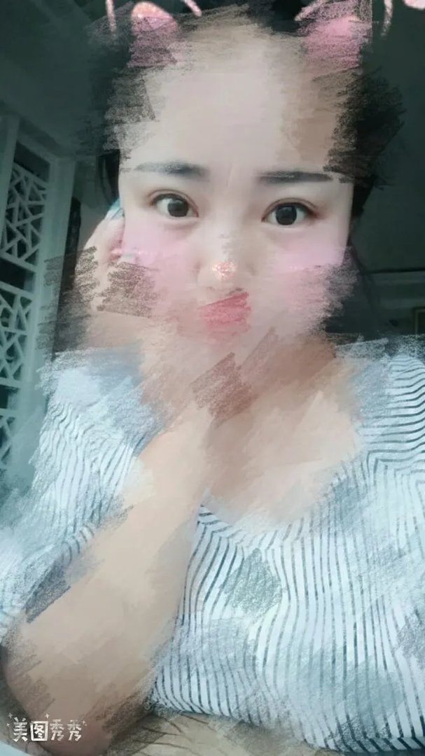 女子纹眉成熊猫眼,女生整形前都不考虑风险么?