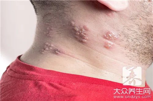  寻麻诊是怎么回事