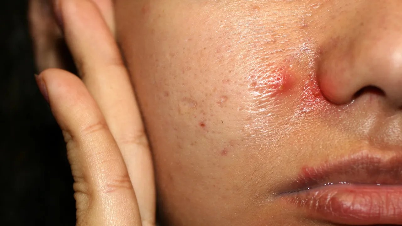 脸过敏发红痒怎么办