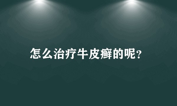 怎么治疗牛皮癣的呢？