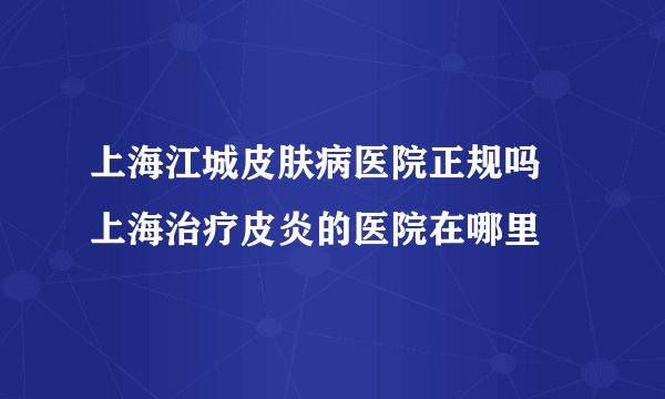 上海江城皮肤病医院正规吗 上海治疗皮炎的医院在哪里
