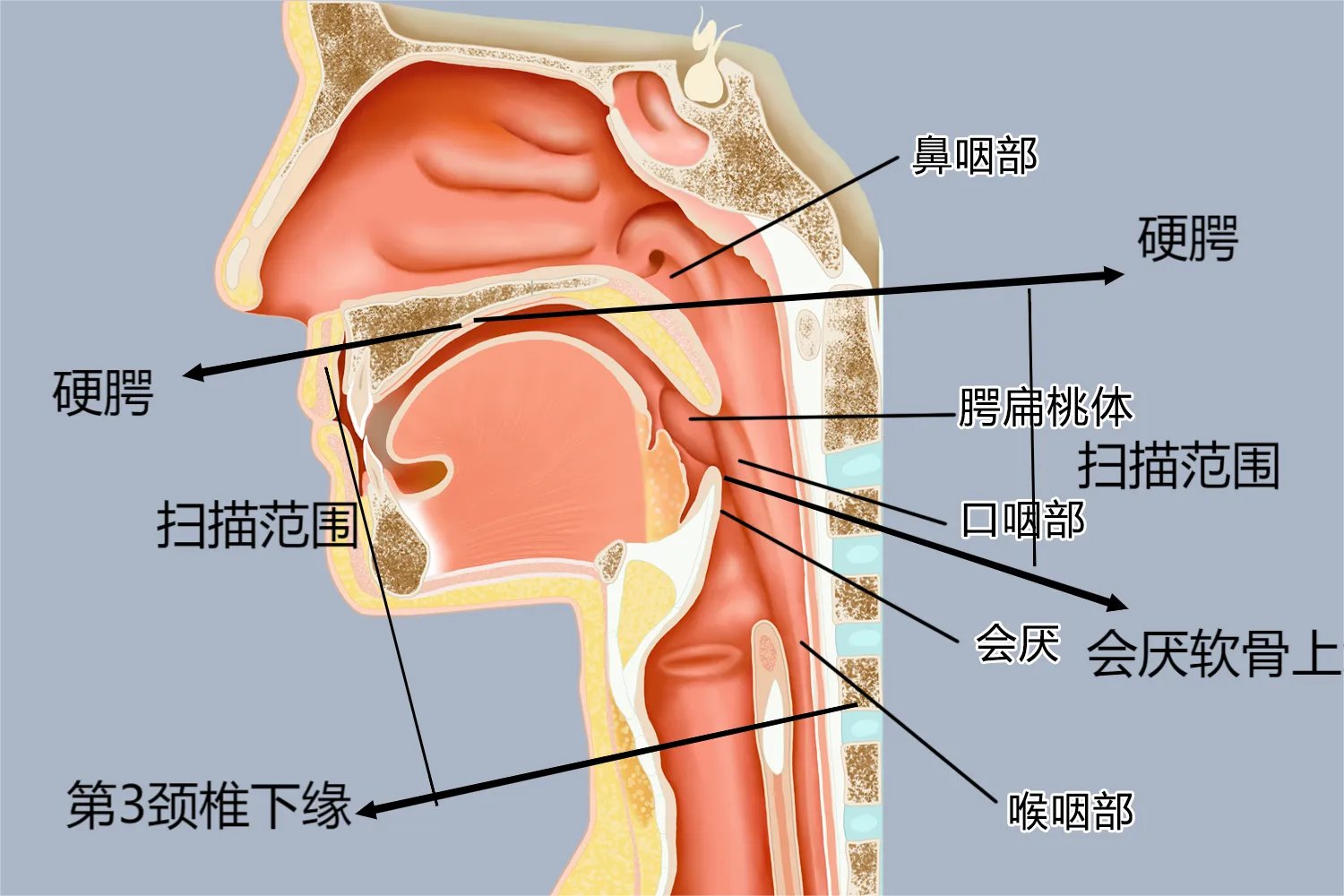 口咽CT扫描范围图片
