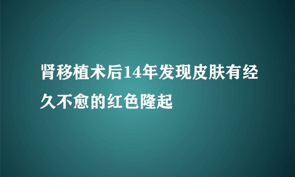 肾移植术后14年发现皮肤有经久不愈的红色隆起