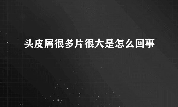 头皮屑很多片很大是怎么回事