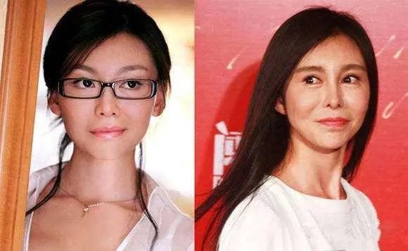 女子纹眉成熊猫眼,女生整形前都不考虑风险么?
