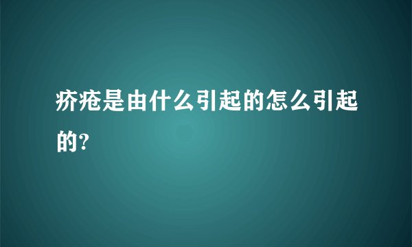 疥疮是由什么引起的怎么引起的?