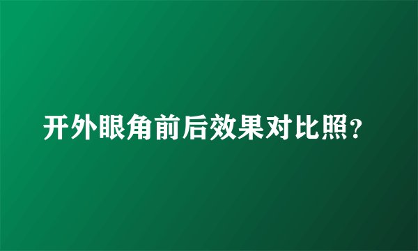 开外眼角前后效果对比照？