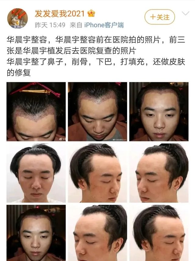如何看待网友「发发爱我2021」爆料放锤华晨宇出轨、整容?事实的真相如何?