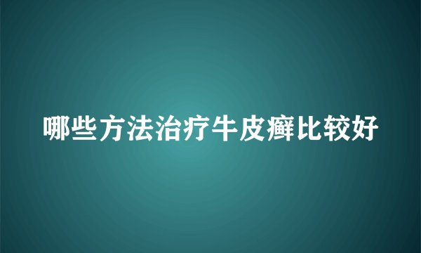 哪些方法治疗牛皮癣比较好