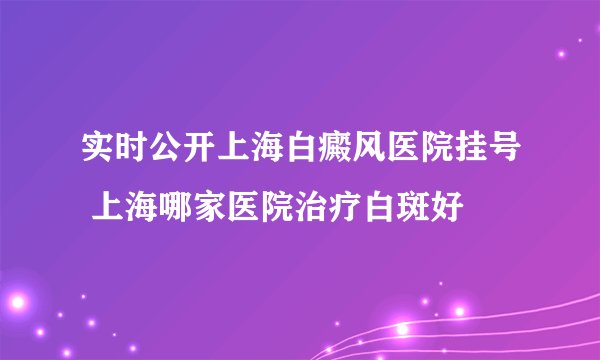 实时公开上海白癜风医院挂号 上海哪家医院治疗白斑好