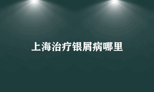 上海治疗银屑病哪里
