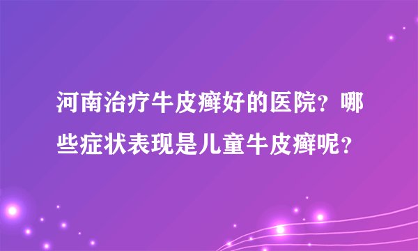 河南治疗牛皮癣好的医院?哪些症状表现是儿童牛皮癣呢?