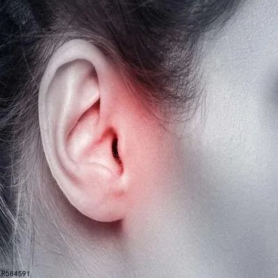 慢性中耳炎怎么根治