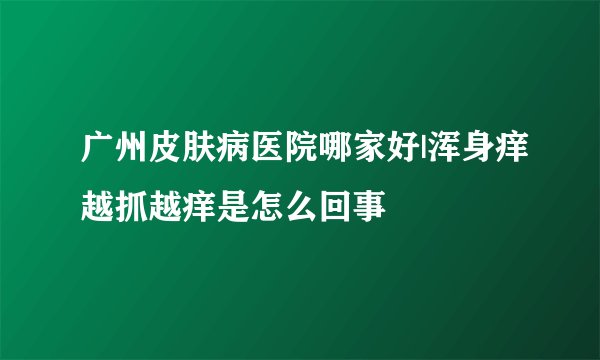 广州皮肤病医院哪家好|浑身痒越抓越痒是怎么回事