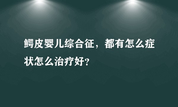 鳄皮婴儿综合征，都有怎么症状怎么治疗好？