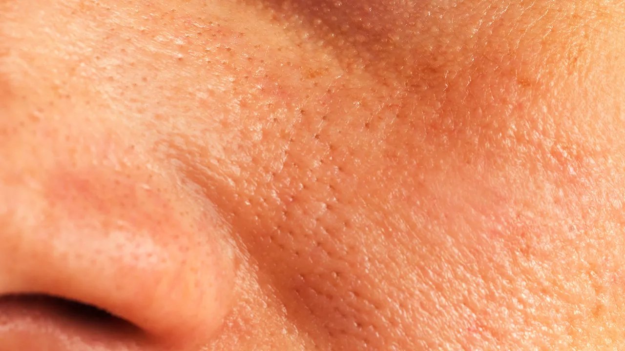 去黑头的最好方法