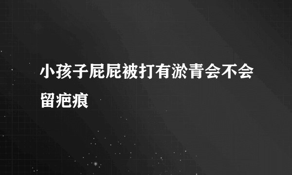 小孩子屁屁被打有淤青会不会留疤痕