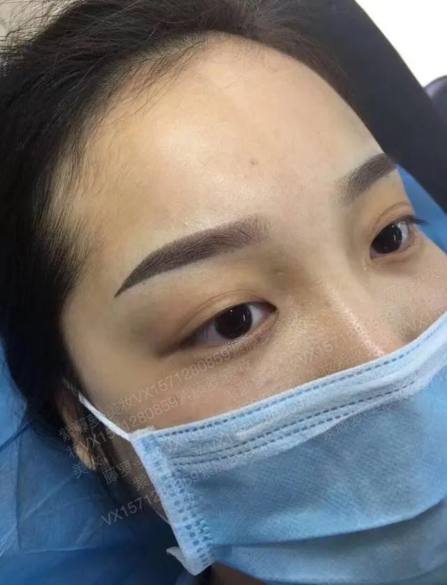 女子纹眉成熊猫眼,女生整形前都不考虑风险么?