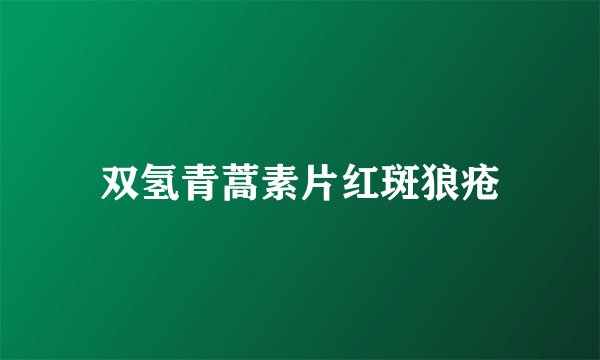 双氢青蒿素片红斑狼疮