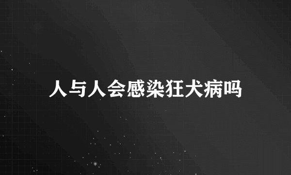 人与人会感染狂犬病吗