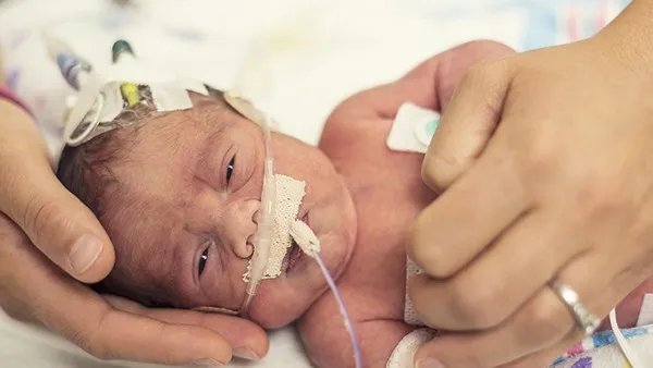 孕妇可以吃火龙果吗 孕妇吃火龙果应该注意什么事项