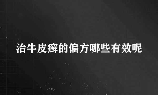 治牛皮癣的偏方哪些有效呢