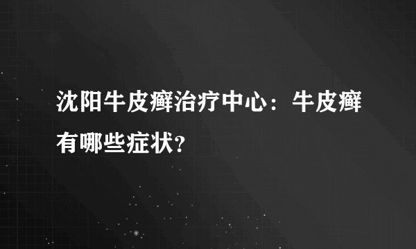 沈阳牛皮癣治疗中心：牛皮癣有哪些症状？