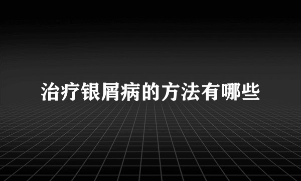 治疗银屑病的方法有哪些