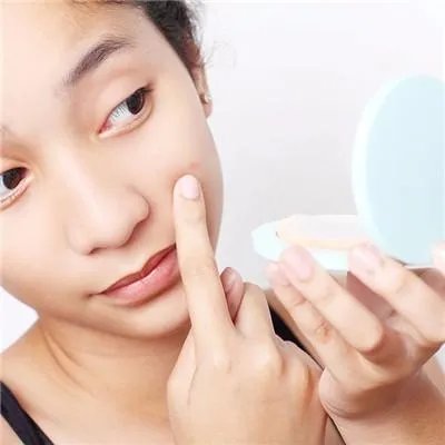 脸上长黄褐斑怎么调理