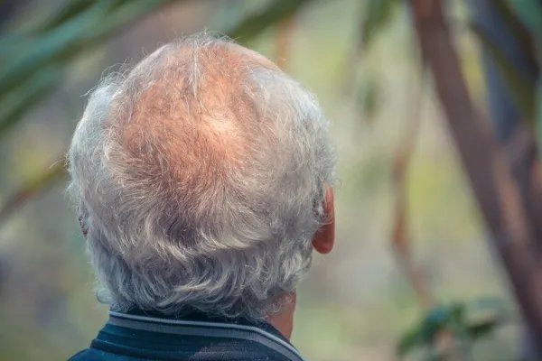 男人40一枝花?不,男人从40开始就衰老了!