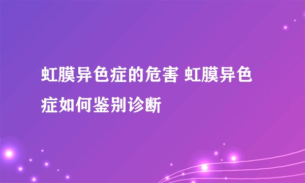 虹膜异色症的危害 虹膜异色症如何鉴别诊断
