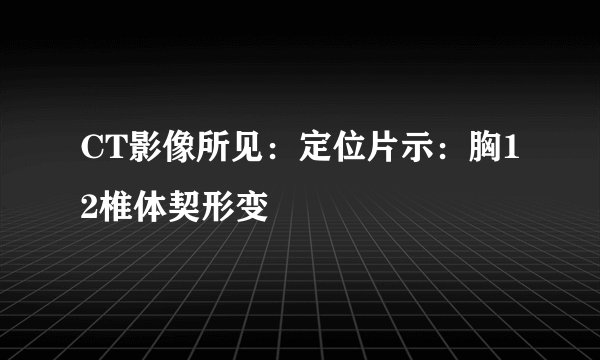 CT影像所见：定位片示：胸12椎体契形变