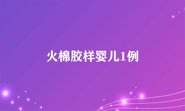 火棉胶样婴儿1例