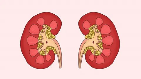 肾小球血尿怎么引起