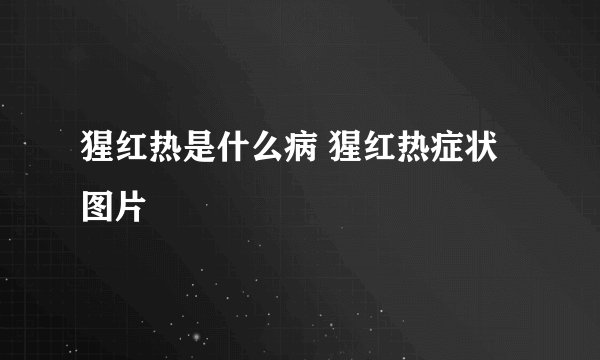 猩红热是什么病 猩红热症状图片