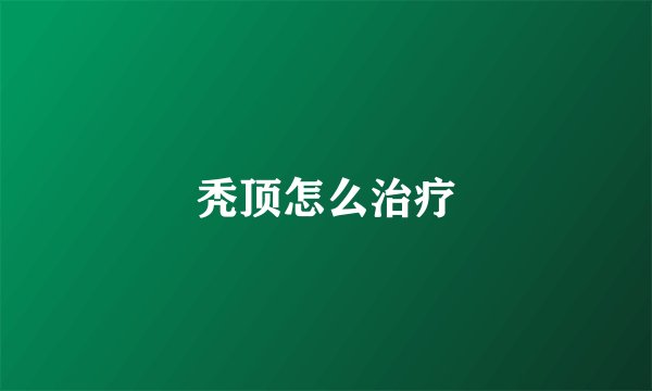 秃顶怎么治疗