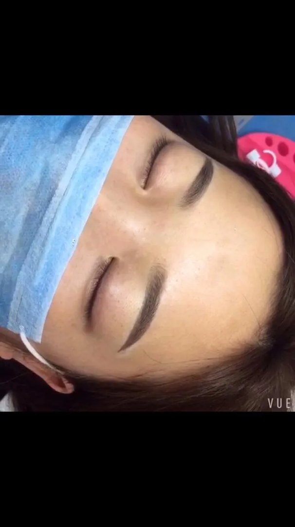 女子纹眉成熊猫眼,女生整形前都不考虑风险么?