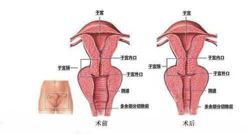 2021武汉中翰整形外科医院女性私密整形价格表(价目表)怎么样?