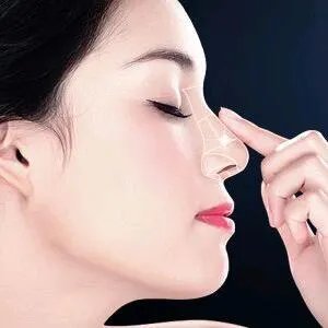 苏州隆鼻手术去哪家整形医院好