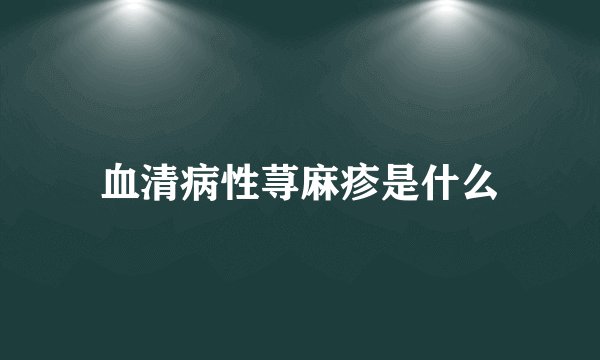 血清病性荨麻疹是什么