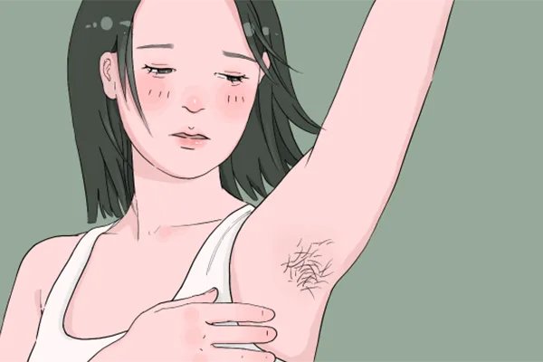 怎么样才可以脱腿毛