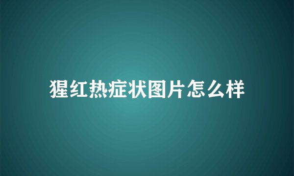 猩红热症状图片怎么样