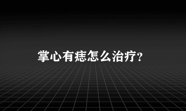 掌心有痣怎么治疗？