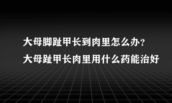 大母脚趾甲长到肉里怎么办？大母趾甲长肉里用什么药能治好